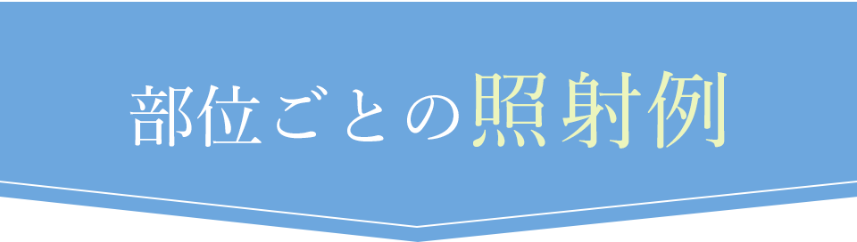 部位ごとの照射例